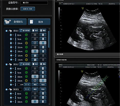 武漢睿影醫(yī)療科技超聲系統(tǒng)軟件界面設(shè)計(jì)